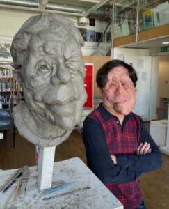 Actor and campaigner Adam Pearson and his portrait bust by sculptor Keziah Burt.